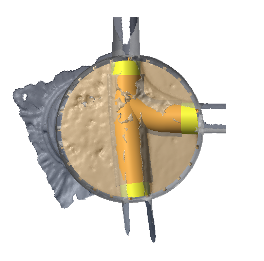 3D Laserscan